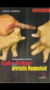 Mengungkap tentang luka bakar & artitis reumatoid